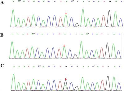 Chronic oral mucocutaneous candidiasis, recurrent respiratory infection, hepatosplenomegaly, and autoimmune diabetes mellitus: A case report of a gain-of-function mutation of STAT1 in a Chinese boy